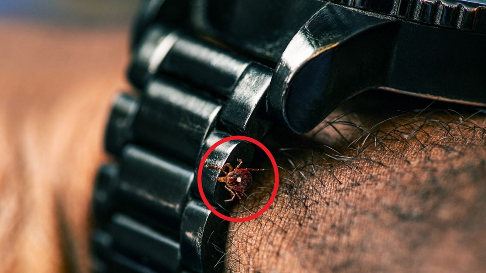 A long star tick on a watch