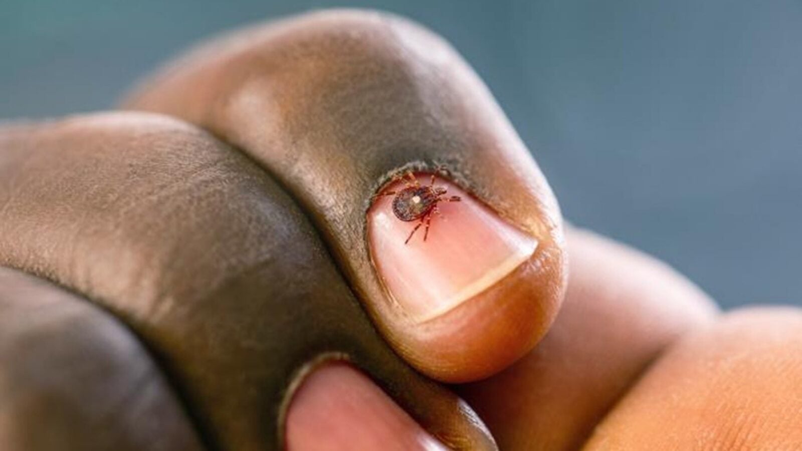 A tick on a finger